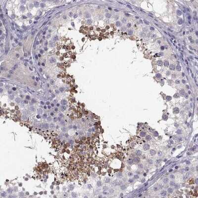 <b>Orthogonal Strategies Validation. </b>Immunohistochemistry-Paraffin: ADAM32 Antibody [NBP1-86198] - Staining of human testis shows high expression.