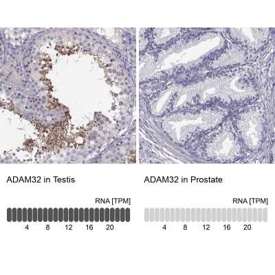 Immunohistochemistry-Paraffin ADAM32 Antibody - BSA Free