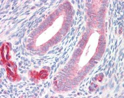 Immunohistochemistry-Paraffin: ADAM33 Antibody [NBP1-30898] - Paraffin-embedded placenta. ADAM33 antibody [C2C3], C-term dilution: 1:100.