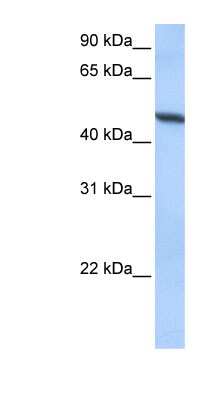 Western Blot: ADAM33 Antibody [NBP1-59046] - Hela cell lysate, concentration 0.2-1 ug/ml.