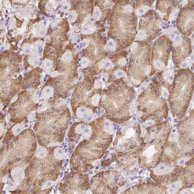 Immunohistochemistry: ADAM8 Antibody [NBP2-39031] - Staining of human stomach shows moderate cytoplasmic positivity in glandular cells.