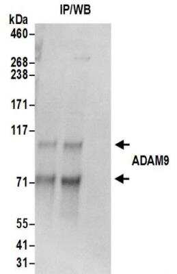 <b>Biological Strategies Validation. </b>Immunoprecipitation: ADAM9 Antibody [NBP2-32260] - Samples:  Whole cell lysate (0.5 or 1.0 mg per IP reaction; 20% of IP loaded) prepared using RIPA buffer from HeLa cells. Antibodies:  Affinity purified rabbit anti-ADAM9 antibody NBP2-32260 used for IP at 6 ug per reaction.  ADAM9 was also immunoprecipitated by rabbit anti-ADAM9 antibody BL16249.  For blotting immunoprecipitated ADAM9, NBP2-32260 was used at 0.4 ug/ml.  Detection: Chemiluminescence with an exposure time of 3 seconds.