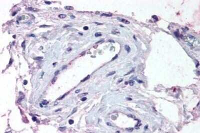 Immunohistochemistry-Paraffin: ADAMTS1 Antibody - BSA Free [NBP1-02338] - Staining of human testis, vessels. Immunohistochemistry of formalin-fixed, paraffin-embedded tissue after heat-induced antigen retrieval. Antibody concentration 13 ug/ml.