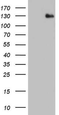 Western Blot: ADAMTS1 Antibody (OTI4H2) - Azide and BSA Free [NBP2-71474] - Analysis of HEK293T cells were transfected with the pCMV6-ENTRY control (Left lane) or pCMV6-ENTRY ADAMTS1.