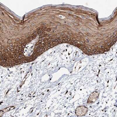 Immunohistochemistry-Paraffin: ADAMTS10 Antibody [NBP1-89248] - Staining of human oral mucosa shows strong cytoplasmic positivity in squamous epithelial cells.