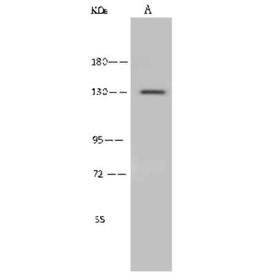 Western Blot: ADAMTS10 Antibody [NBP2-99535] - Anti-ADAMTS10 rabbit polyclonal antibody at 1:500 dilution. Lane A: Mouse brain tissue lysate Lysates/proteins at 30 ug per lane. Secondary Goat Anti-Rabbit IgG (H+L)/HRP at 1/10000 dilution. Developed using the ECL technique. Performed under reducing conditions. Predicted band size: 121 kDa. Observed band size: 130 kDa