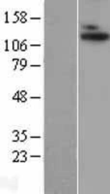 Western Blot: ADAMTS10 Overexpression Lysate (Adult Normal) [NBL1-07315] Left-Empty vector transfected control cell lysate (HEK293 cell lysate); Right -Over-expression Lysate for ADAMTS10.