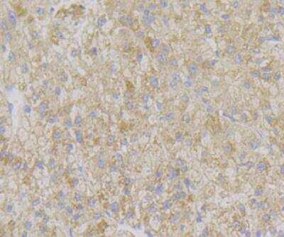 Immunohistochemistry: ADAMTS13 Antibody (JG39-21) [NBP2-76975] - Immunohistochemical analysis of paraffin-embedded human liver tissue using anti-ADAMTS13 antibody. Counter stained with hematoxylin.