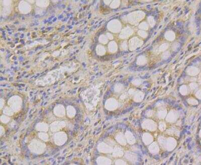 Immunohistochemistry: ADAMTS13 Antibody (JG39-21) [NBP2-76975] - Immunohistochemical analysis of paraffin-embedded human colon tissue using anti-ADAMTS13 antibody. Counter stained with hematoxylin.