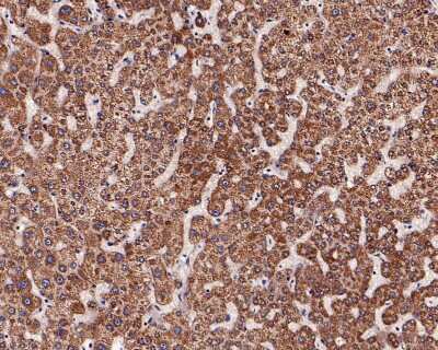 Immunohistochemistry-Paraffin: ADAMTS13 Antibody (JG39-21) [NBP2-76975] - Analysis of paraffin-embedded human liver tissue with Rabbit anti-ADAMTS13 antibody washed with ddH2O and PBS, and then probed with the primary antibody  at 1/200 dilution for 1 hour at room temperature. The detection was performed using an HRP conjugated compact polymer system. DAB was used as the chromogen. Tissues were counterstained with hematoxylin and mounted with DPX.