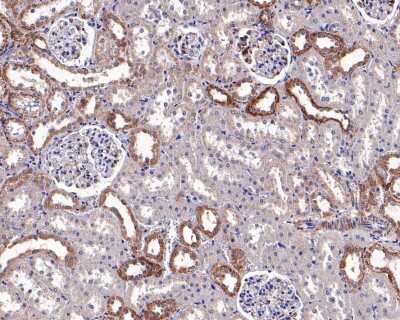 Immunohistochemistry-Paraffin: ADAMTS13 Antibody (JG39-21) [NBP2-76975] - Analysis of paraffin-embedded rat kidney tissue with Rabbit anti-ADAMTS13 antibody washed with ddH2O and PBS, and then probed with the primary antibody  at 1/200 dilution for 1 hour at room temperature. The detection was performed using an HRP conjugated compact polymer system. DAB was used as the chromogen. Tissues were counterstained with hematoxylin and mounted with DPX.