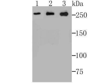 Western Blot: ADAMTS13 Antibody (JG39-21) [NBP2-76975] - Western blot analysis of ADAMTS13 on SiHa cell (1), PC-3M cell (2) and A549 cell lysates using anti-ADAMTS13 antibody at 1/500 dilution.
