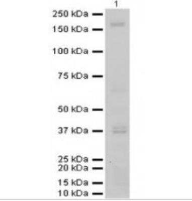 Western Blot: ADAMTS13 Antibody [NB110-82382] - Mouse liver lysate. Antibody dilution 1:500