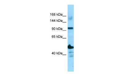 Western Blot: ADAMTS14 Antibody [NBP3-10684] - Western blot analysis of ADAMTS14 in OVCAR-3 Whole Cell as a positive control. Antibody dilution at 1.0 ug/ml