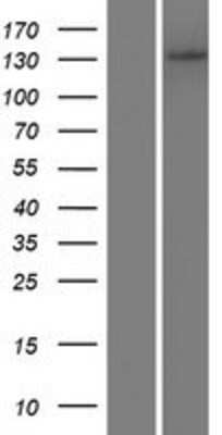 Western Blot: ADAMTS14 Overexpression Lysate (Adult Normal) [NBP2-05595] Left-Empty vector transfected control cell lysate (HEK293 cell lysate); Right -Over-expression Lysate for ADAMTS14.