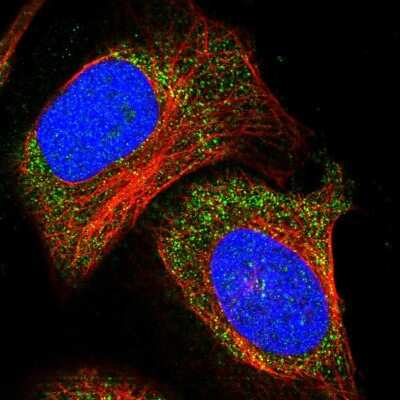 Immunocytochemistry/Immunofluorescence: ADAMTS15 Antibody [NBP1-86209] - Immunofluorescent staining of human cell line U-2 OS shows localization to cytosol.