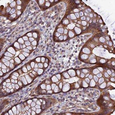 Immunohistochemistry-Paraffin: ADAMTS15 Antibody [NBP1-86209] - Staining of human rectum shows strong cytoplasmic and membranous positivity in glandular cells.