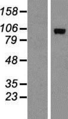 Western Blot: ADAMTS15 Overexpression Lysate (Adult Normal) [NBP2-05604] Left-Empty vector transfected control cell lysate (HEK293 cell lysate); Right -Over-expression Lysate for ADAMTS15.