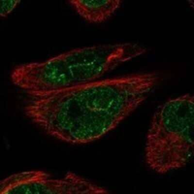 Immunocytochemistry/ Immunofluorescence ADAMTS16 Antibody