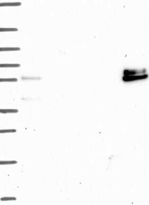 Western Blot ADAMTS16 Antibody