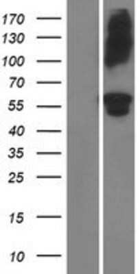 Western Blot: ADAMTS16 Overexpression Lysate (Adult Normal) [NBP2-05605] Left-Empty vector transfected control cell lysate (HEK293 cell lysate); Right -Over-expression Lysate for ADAMTS16.