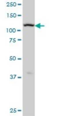 Western Blot: ADAMTS17 Antibody (3B7) [H00170691-M01] - ADAMTS17 monoclonal antibody (M01), clone 3B7 Analysis of ADAMTS17 expression in A-431.