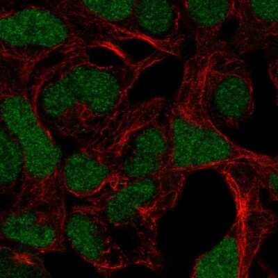 Immunocytochemistry/ Immunofluorescence ADAMTS17 Antibody - BSA Free