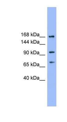 Western Blot: ADAMTS19 Antibody [NBP1-69170] - Titration: 0.2-1 ug/ml, Positive Control: THP-1 cell lysate.