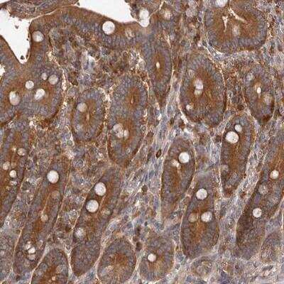 Immunohistochemistry-Paraffin ADAMTS20 Antibody