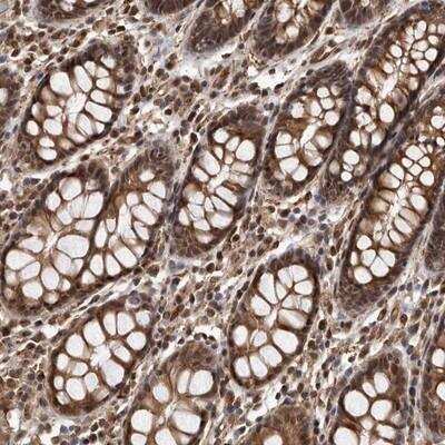 Immunohistochemistry-Paraffin ADAMTS20 Antibody - BSA Free