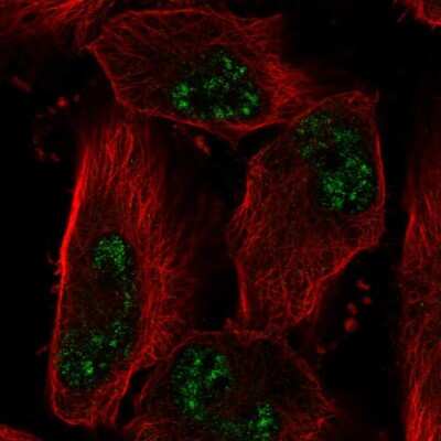 Immunocytochemistry/Immunofluorescence: ADAMTS4 Antibody [NBP2-56239] - Staining of human cell line U-251 MG shows localization to nuclear speckles.