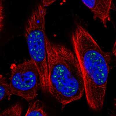 Immunocytochemistry/Immunofluorescence: ADAMTS4 Antibody [NBP2-57839] - Staining of human cell line U-251 MG shows localization to nuclear speckles.