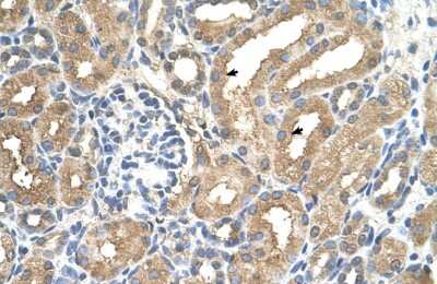 Immunohistochemistry-Paraffin: ADAMTS4 Antibody [NBP1-54369] - Human kidney Tissue, antibody concentration 4-8ug/ml. Cells with positive label: renal corpuscle cells (indicated with arrows) 400X magnification.