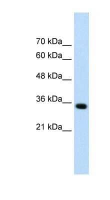 Western Blot: ADAMTS4 Antibody [NBP1-54369] - HepG2 cell lysate, Antibody Titration: 0.2-1 ug/ml