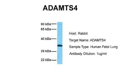 Western Blot: ADAMTS4 Antibody [NBP1-54369] - Sample Tissue: Human Fetal Lung Antibody Dilution: 1.0 ug/ml