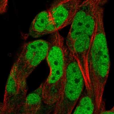 Immunocytochemistry/Immunofluorescence: ADAMTS5 Antibody [NBP2-55653] - Staining of human cell line RH-30 shows localization to nucleoplasm.