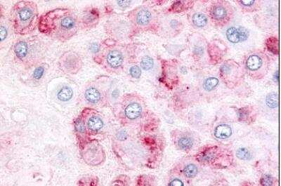 Immunohistochemistry-Paraffin: ADAMTS5 Antibody [NLS7761] - Human placenta. Immunohistochemistry of formalin-fixed, paraffin-embedded tissue after heat-induced antigen retrieval.