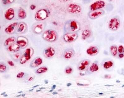 Immunohistochemistry-Paraffin: ADAMTS5 Antibody [NLS7768] - IHC analysis of Cartilage using this antibody at 2 ug/ ml.