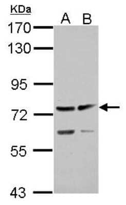 Western Blot: ADAMTS5 Antibody [NBP2-15286] - Sample (30 ug of whole cell lysate) A: HeLa B: HepG2 7. 5% SDS PAGE, antibody diluted at 1:3000.