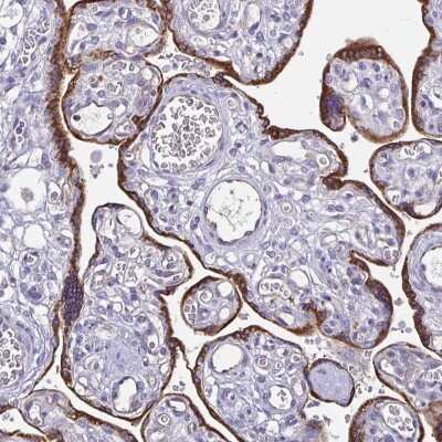 Immunohistochemistry-Paraffin ADAMTS6 Antibody - BSA Free