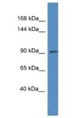 Western Blot ADAMTS6 Antibody - BSA Free