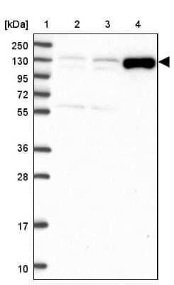 Western Blot ADAMTS6 Antibody - BSA Free