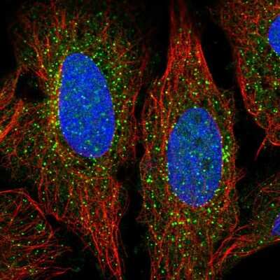 Immunocytochemistry/ Immunofluorescence ADAMTS7 Antibody - BSA Free