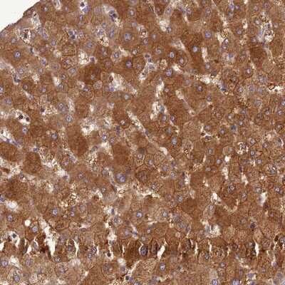 Immunohistochemistry ADAMTS7 Antibody