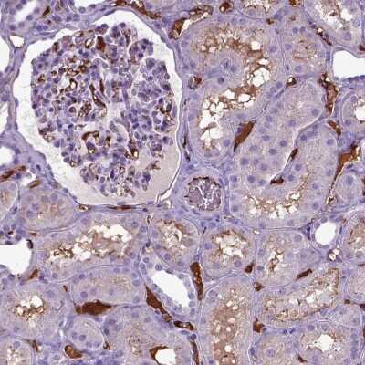 Immunohistochemistry: ADAMTS8 Antibody [NBP2-49480] - Staining of human kidney shows strong positivity in blood vessels and plasma.