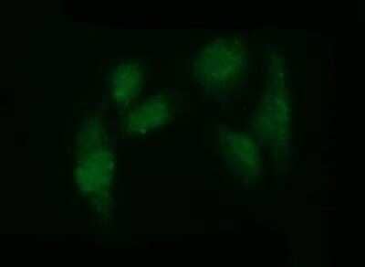 Immunocytochemistry/Immunofluorescence: ADAMTS8 Antibody (OTI2H5) - Azide and BSA Free [NBP2-71677] - Analysis of HeLa cells.
