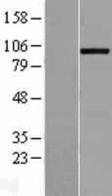 Western Blot: ADAMTS8 Overexpression Lysate (Adult Normal) [NBL1-07318] Left-Empty vector transfected control cell lysate (HEK293 cell lysate); Right -Over-expression Lysate for ADAMTS8.
