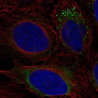 Immunocytochemistry/Immunofluorescence: ADAMTS9 Antibody [NBP2-55347] - Staining of human cell line U-2 OS shows localization to endoplasmic reticulum & vesicles.