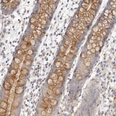 Immunohistochemistry-Paraffin: ADAMTS9 Antibody [NBP1-82915] - Staining of human duodenum shows moderate positivity in cytoplasm and secreted in glandular cells.