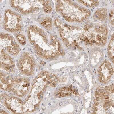 Immunohistochemistry-Paraffin: ADAMTS9 Antibody [NBP1-82915] - Staining of human kidney shows moderate cytoplasmic positivity in cells in tubules.